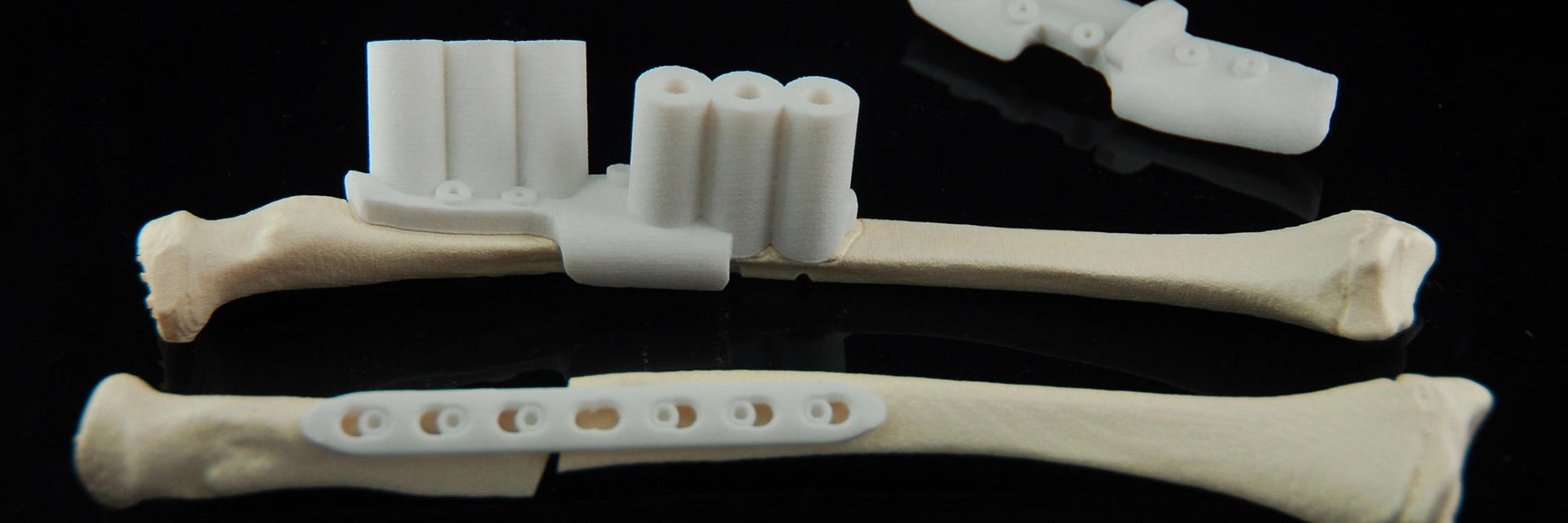 3D-printed bones with personalized surgical guides attached 