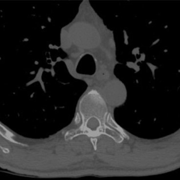 Materialise Mimics Core | 3D Medical Image Segmentation Software
