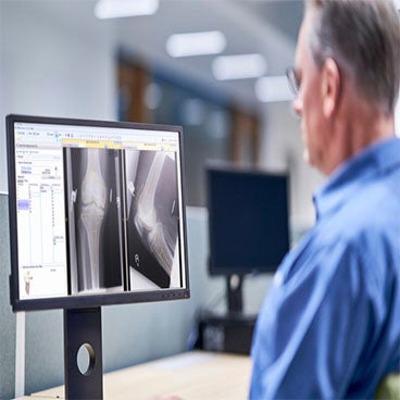 How to Plan a Total Hip Arthroplasty in Less than 60 Seconds 