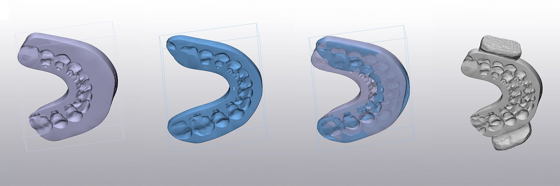 Four digital renderings of a dental model, showing progressive stages of refinement from a basic purple scan to a detailed grey 3D model with clearly defined teeth.