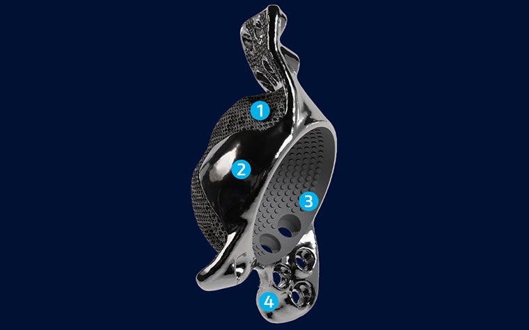 materialise-amace-3d-printed-implant.jpg