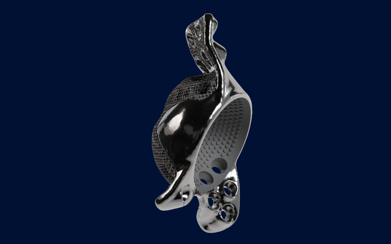 materialise-amace-3d-printed-implant.png