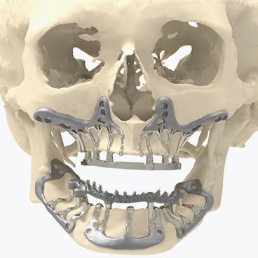 健康・医学 216 IMPLANTS Ultimate guide 健康・医学 216 IMPLANTS Ultimate guide 健康・医学 216