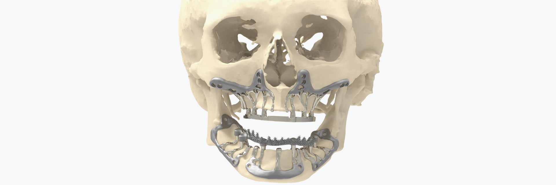 健康・医学 216 IMPLANTS Ultimate guide 健康・医学 216 IMPLANTS Ultimate guide 216 IMPLANTS Ultimate