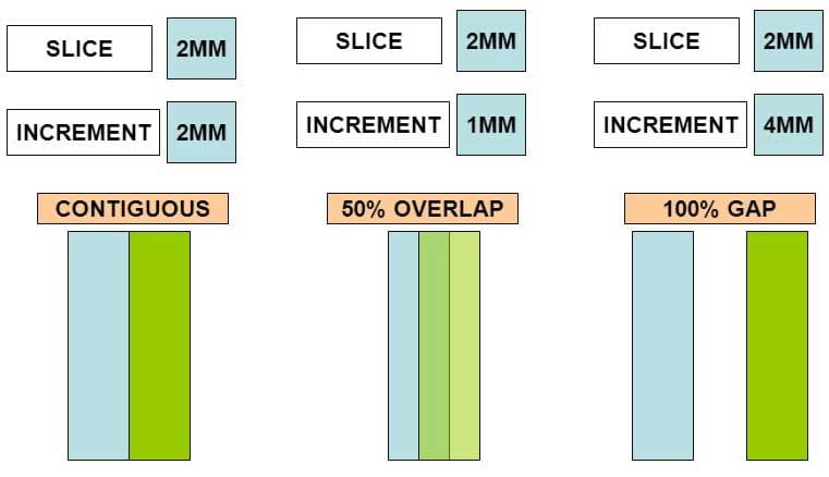 Graphic showing slice variations