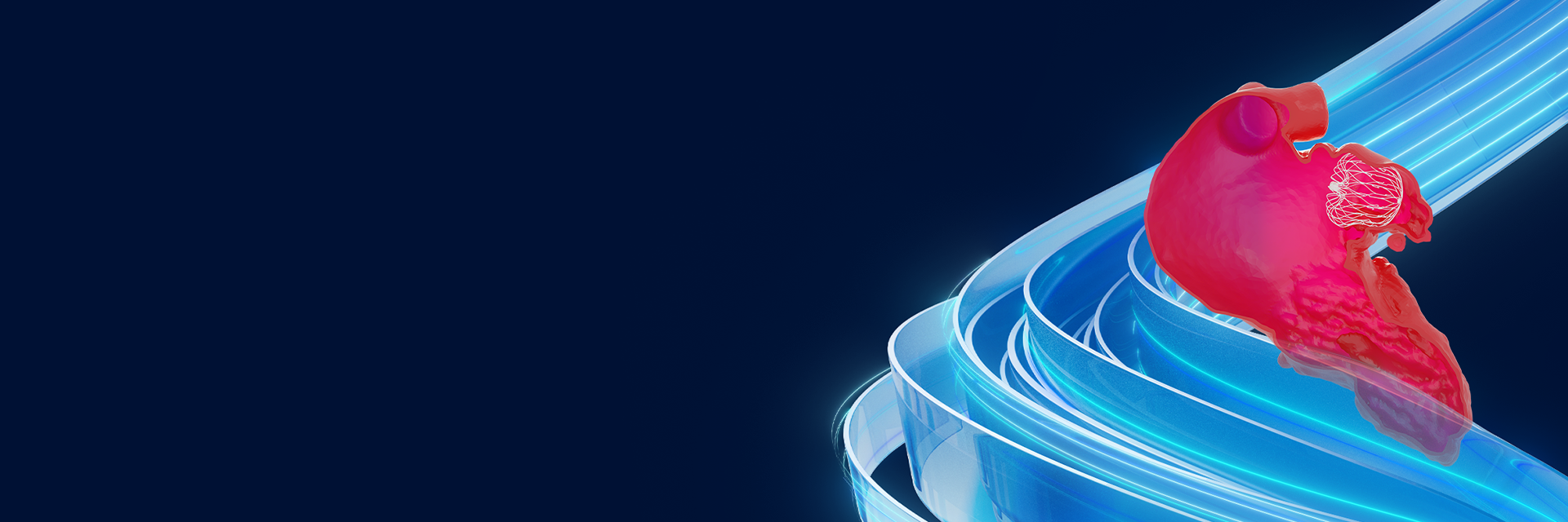 LAAO shown in a cutaway anatomy of a heart with a blue Mimics swirl background.