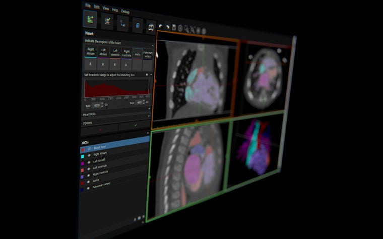 Image of computer screen with anatomy scans 