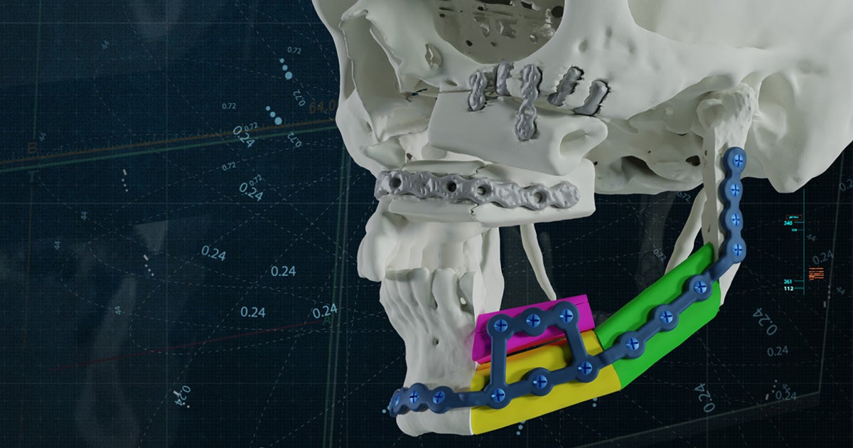 og-3d-model-skull-3d-printed-