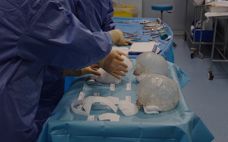 Two surgeons in scrubs reviewing a surgical table full of tools for the surgery, including skull models and personalized 3D-printed guides