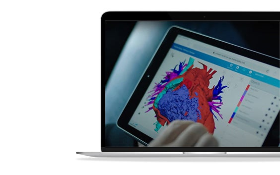 ssm-ipad-surgicase-3d-model-heart.jpg