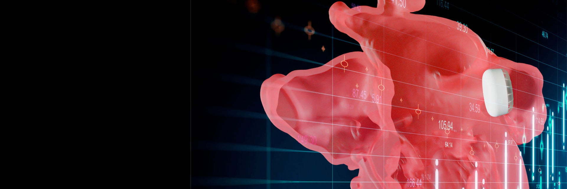 Digital visual of the Mimics Enlight LAAO Planner 