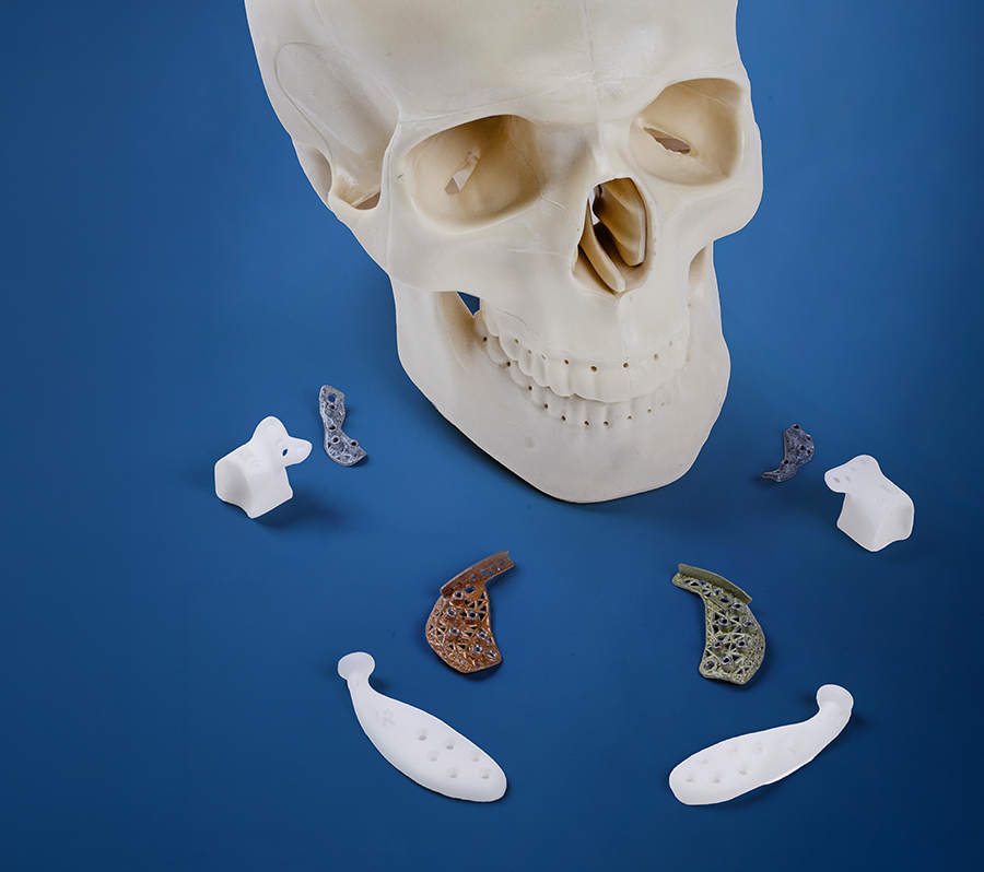 TMJ surgery