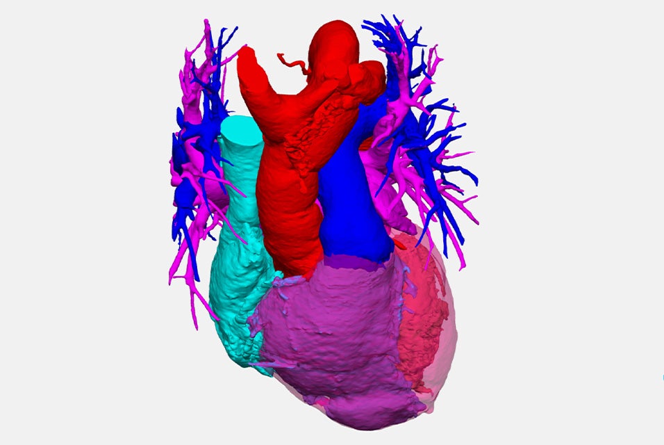 A 3D model of a segmented heart anatomy