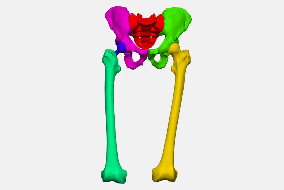 A 3D model of a segmented hip and upper leg anatomy