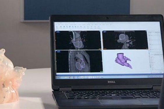Laptop on a desk with Mimics showing anatomy scans