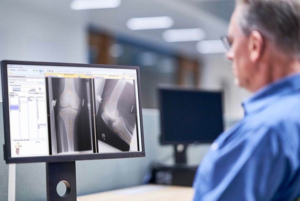 Man sitting at a desk using Materialise OrthoView