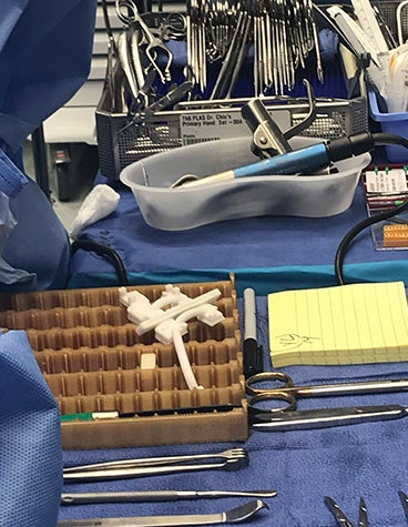 手の移植に使用するプランニングとガイド