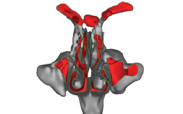 Anatomy scan with red overlays on a patient's reconstructed nasal cavity