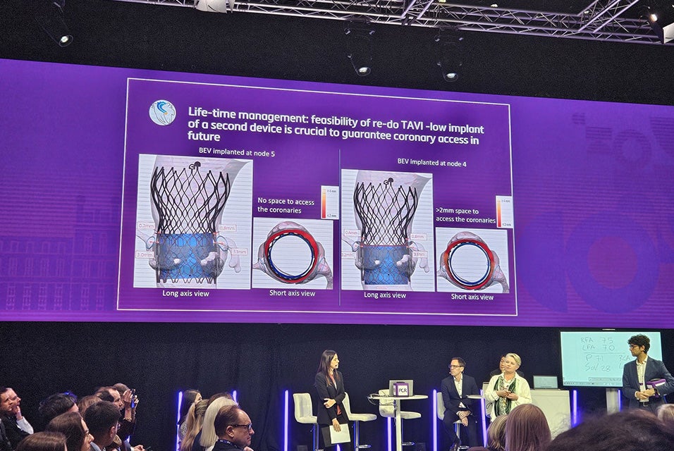 A group of people, including Dr. Wykrzykowska, standing on stage at PCR London Valves 2025 in front of a live audience, with a presentation on the screen behind her.
