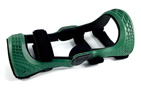 Orthèse personnalisée imprimée en 3D par Berretta Medical Inc.