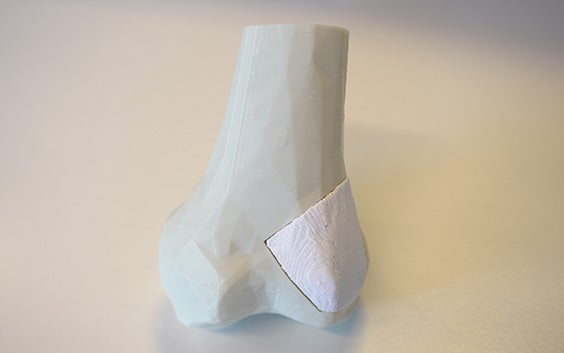 hm-3d-printed-bone-model-implant.jpg