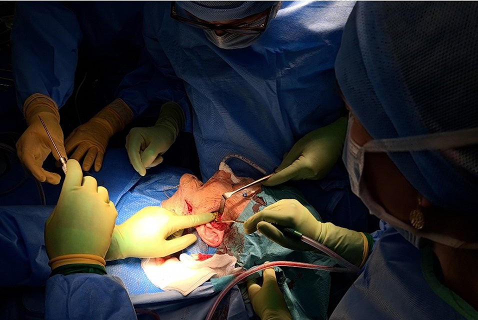 Surgeons fixating a temporal component during TMJ surgery