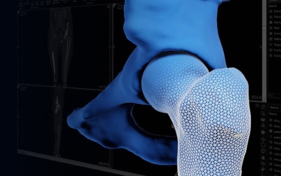 Digitales Bild eines Knochens mit Markierungen auf dem unteren Vorderteil