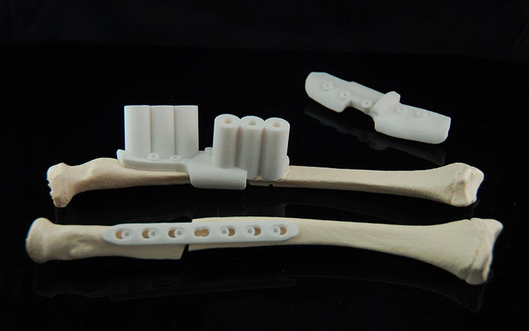 3D-printed bone replicas with attached surgical guides, designed to assist in precise drilling and implantation during orthopaedic procedures.