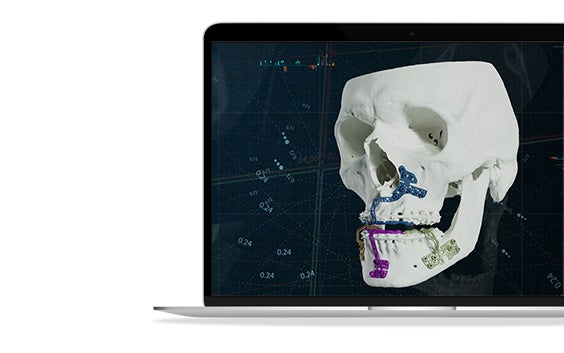 ssm-materialise-cmf-solutions-3d-printed-guides-skull-mios.jpg