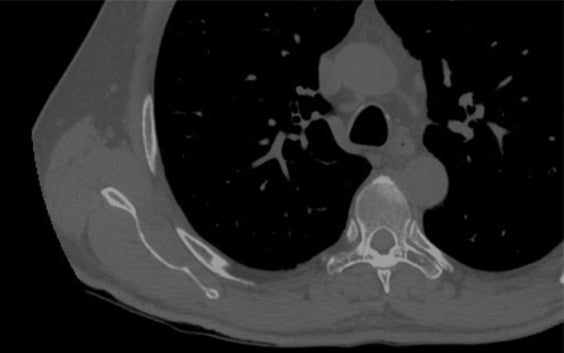 How to Get Started with Mimics