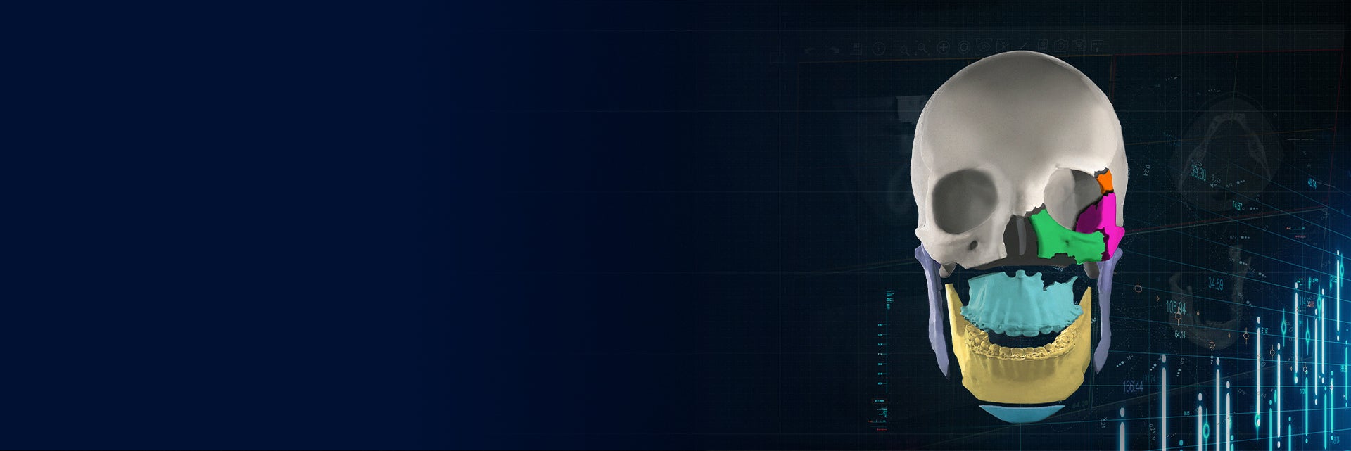 A 3D render of a human skull, segmented into multi-colored sections