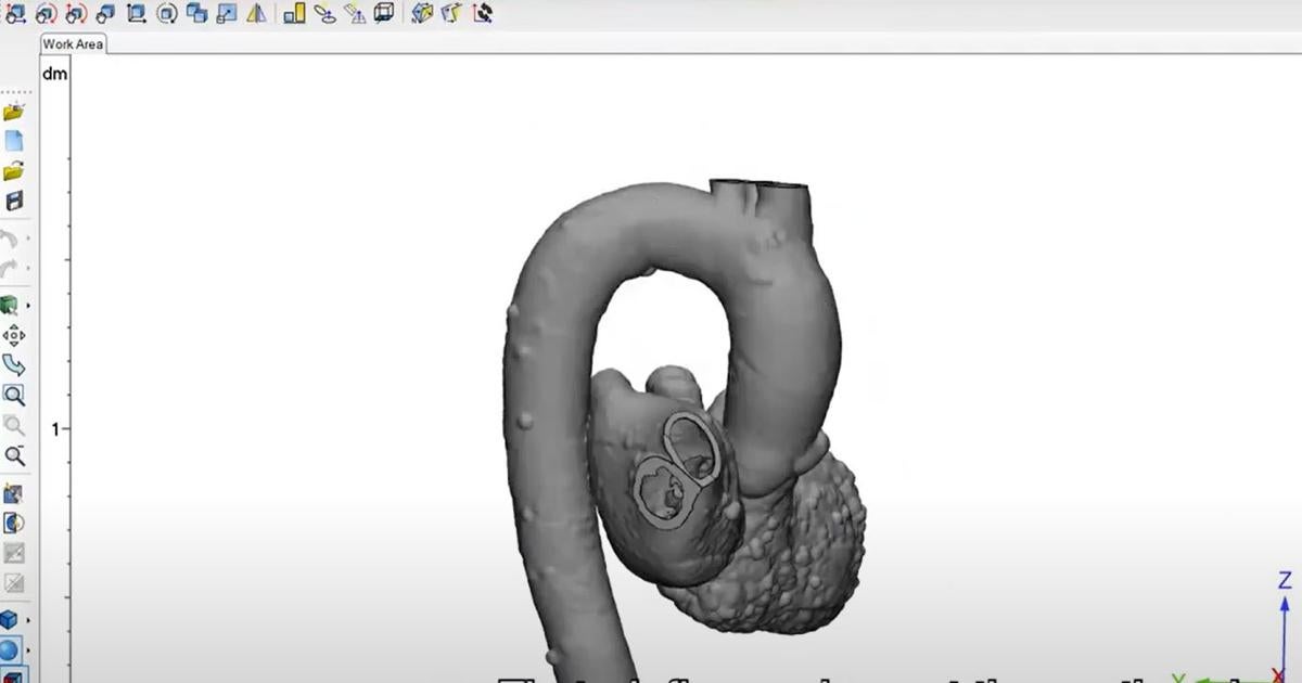 Tutorial: Perform Advanced Measurements on Heart