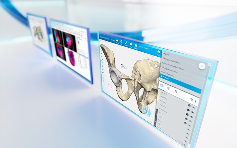 Materialise Mimics Viewer | Interactive 3D Viewer for Medical Cases