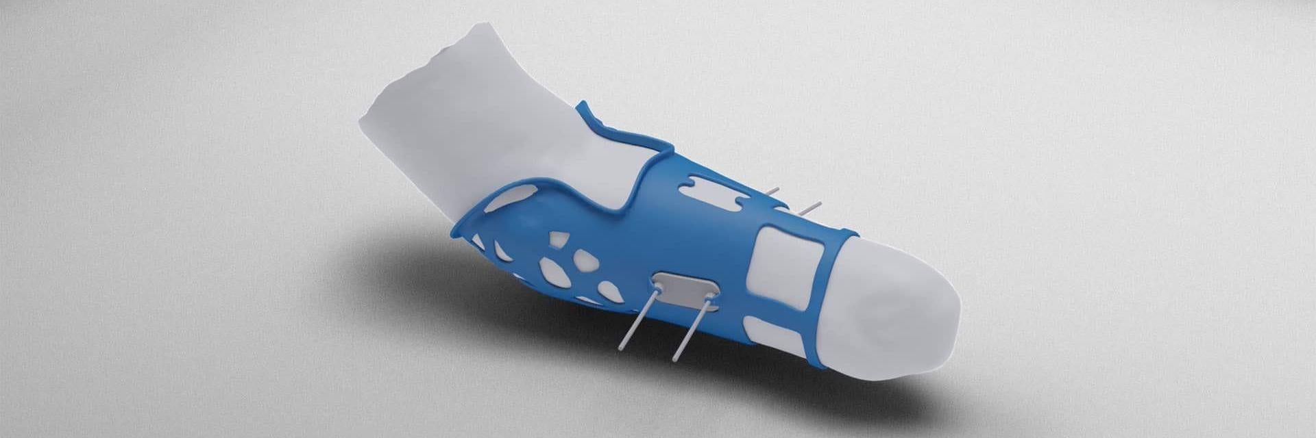 HeyGears’ Personalized Prosthetic Designs Materialise Case Study