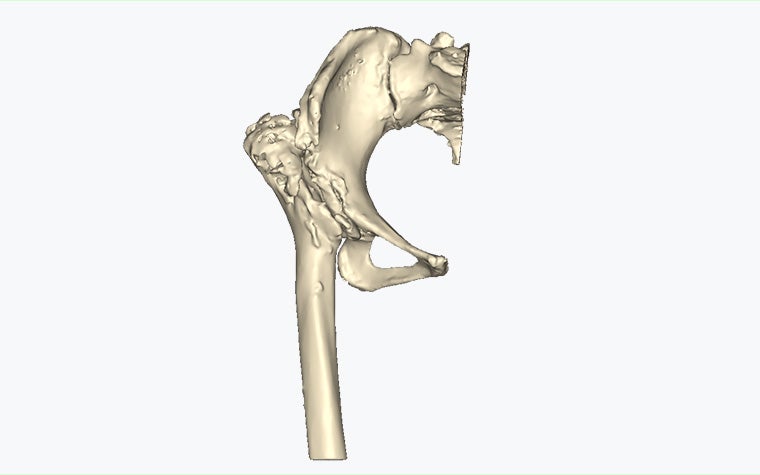A 3D model of a hip bone and femur