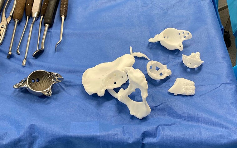 The operating room table with the aMace implant, surgical guides and models, and surgical tools