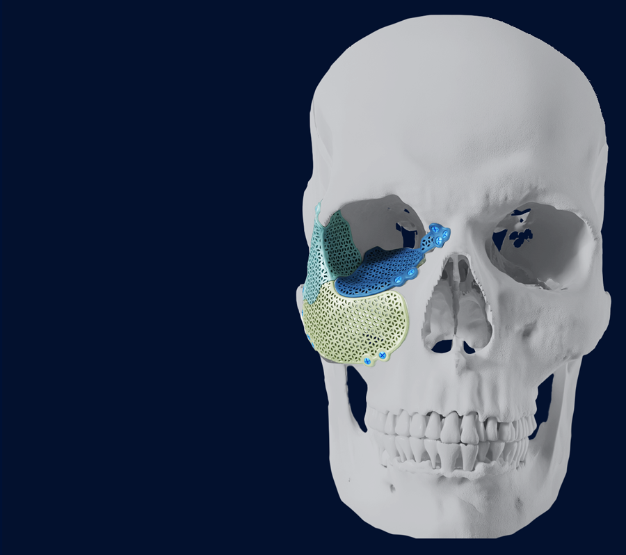 Trauma surgery
