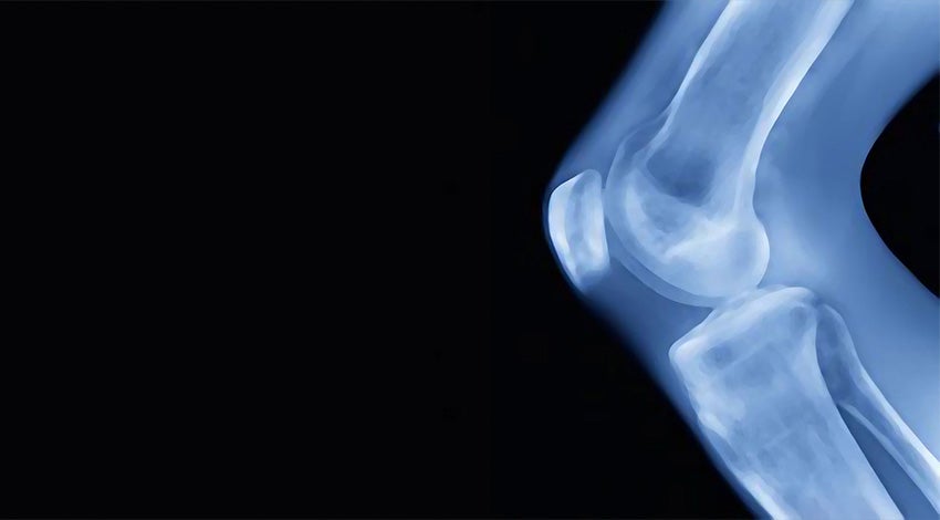 Digital anatomy scan of a joint on a black background