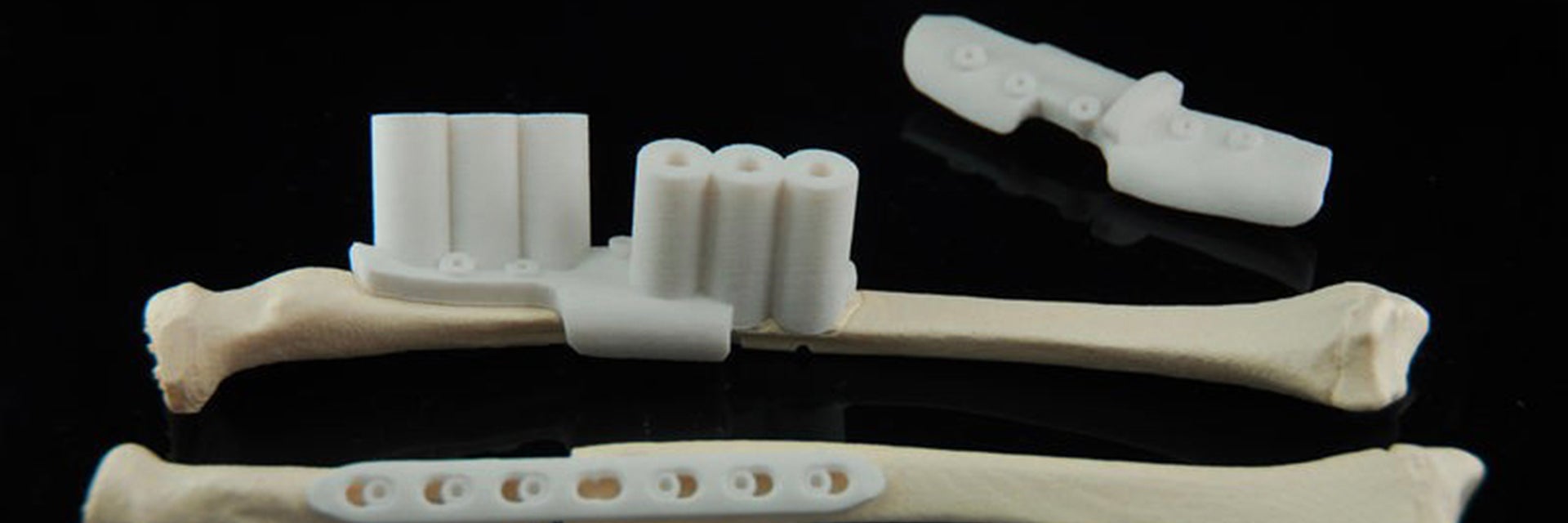 3D-printed surgical guides on bone models