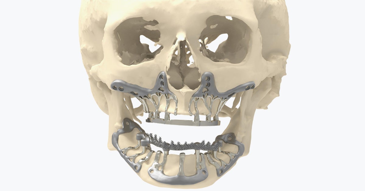 健康・医学 216 IMPLANTS Ultimate guide 健康・医学 216 IMPLANTS Ultimate guide 216 IMPLANTS Ultimate