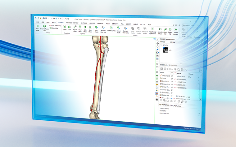 Materialise Mimics software displayed a cutting guide design on a patient bone with blue swirly lines in the background