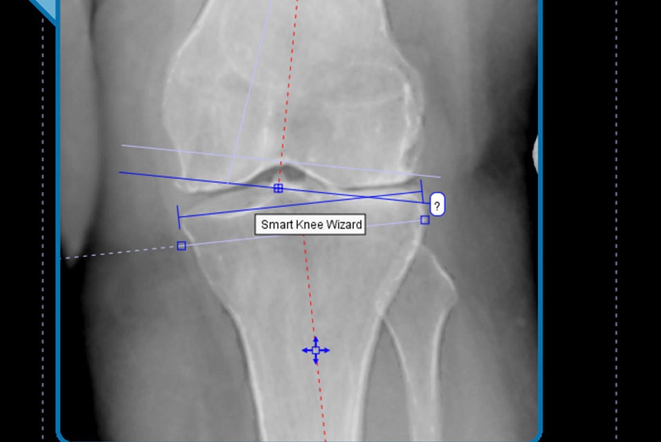 Tutorials | Mimics Orthoview | Materialise Academy