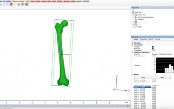 Statistical Shape Model Bone Anatomical Analysis for Academia | Materialise Mimics