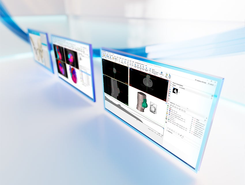 Tres pantallas que muestran la anatomía del paciente dentro del software de la plataforma Materialise Mimics sobre un fondo blanco reflectante con líneas azules.