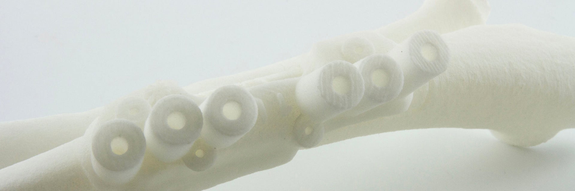 3D-printed surgical guide 