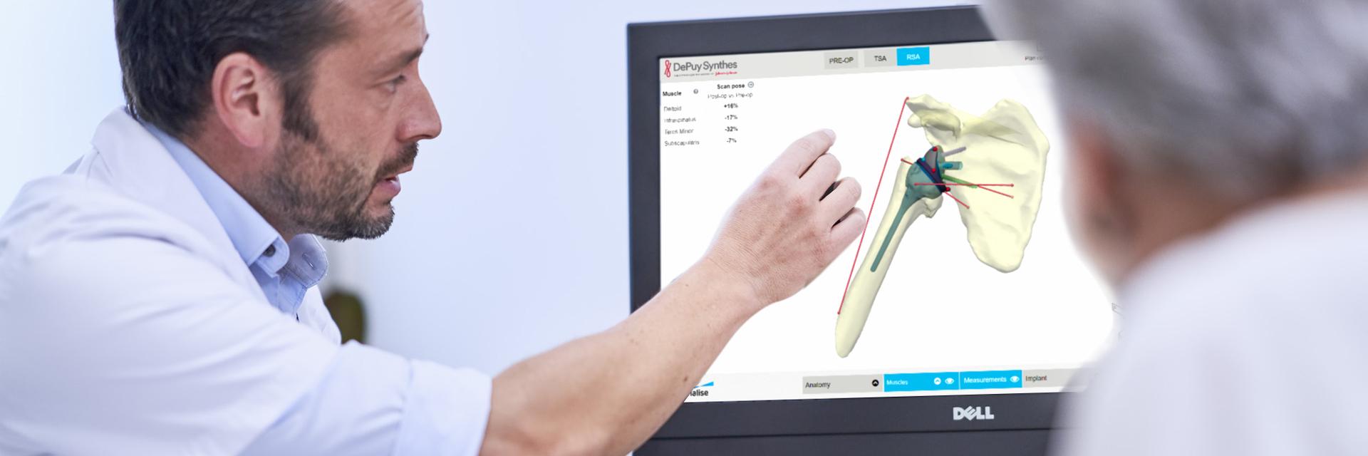 Doctor showing an elderly female patient a preoperative shoulder plan on a computer monitor