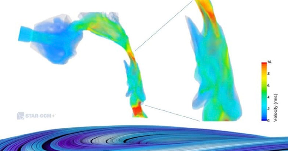 Webinar: Simulating Airflow In Dynamic Airway Models