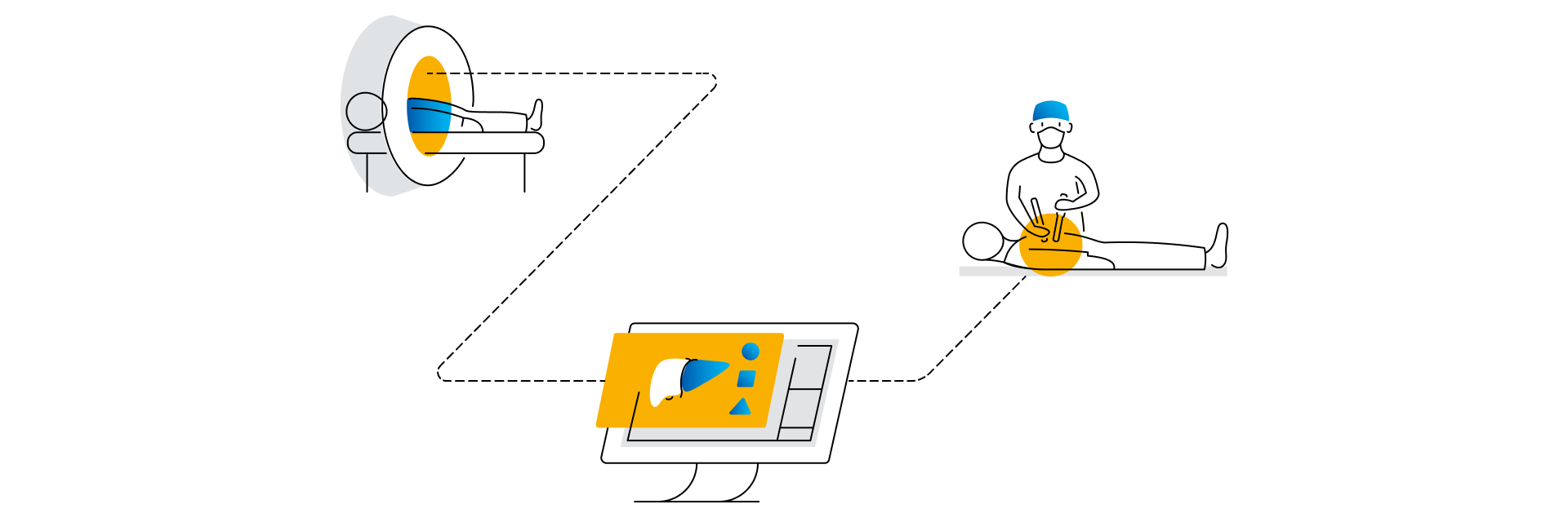 Illustration of a medical workflow connecting MRI imaging, surgical planning software for hepatic surgery, and a clinician performing a procedure on a patient. 