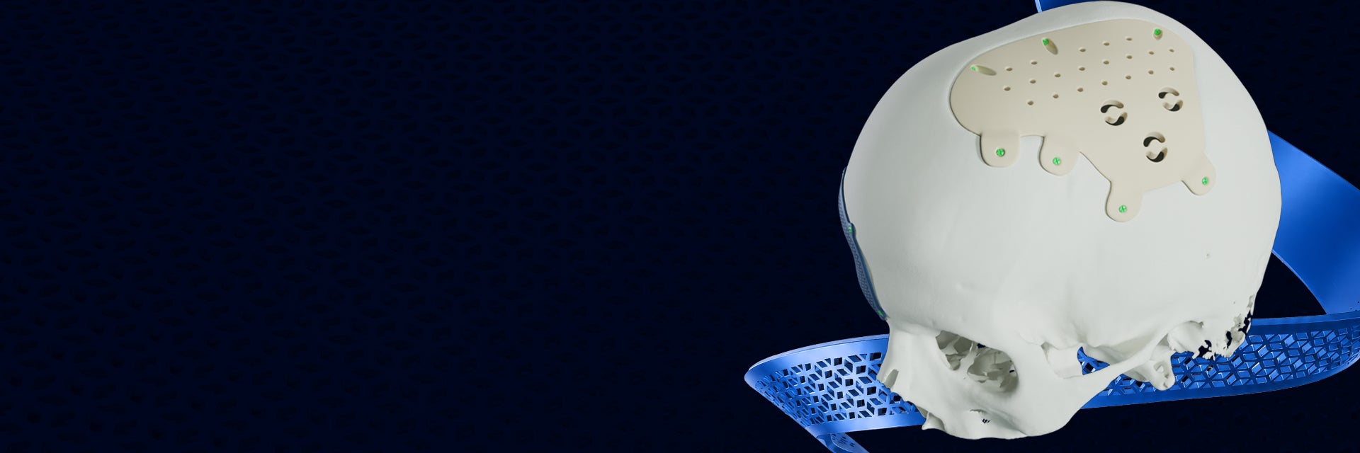 Un cráneo blanco con un implante Materialise CMF PEEK sobre fondo azul.
