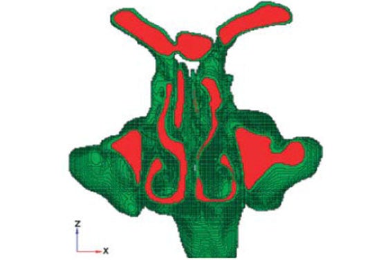 Image of a virtual mesh numerical simulation on anatomy